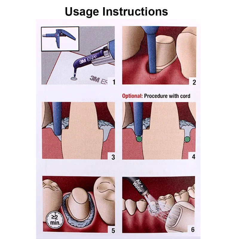 Dental Materials 3M ESPE Astringent Retraction Paste 0.3g/piece Hemostatic and Gum Drainage Disposable Supplement Capsule
