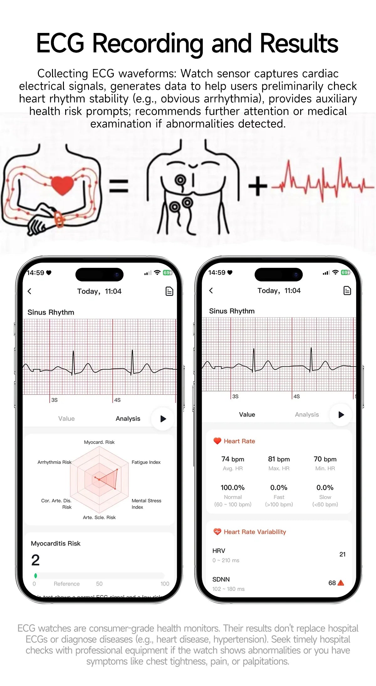 Smart Health Watch 2025